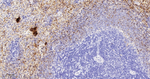 PF4 Antibody in Immunohistochemistry (Paraffin) (IHC (P))