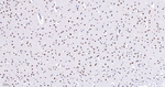 SIN3A Antibody in Immunohistochemistry (Paraffin) (IHC (P))