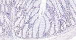 SIN3A Antibody in Immunohistochemistry (Paraffin) (IHC (P))