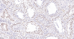 SIN3A Antibody in Immunohistochemistry (Paraffin) (IHC (P))