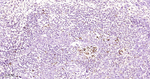 PRDX3 Antibody in Immunohistochemistry (Paraffin) (IHC (P))