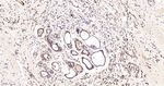 IDH2 Antibody in Immunohistochemistry (Paraffin) (IHC (P))