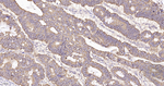 IDH2 Antibody in Immunohistochemistry (Paraffin) (IHC (P))