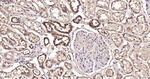IDH2 Antibody in Immunohistochemistry (Paraffin) (IHC (P))