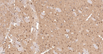 Dynamin 2 Antibody in Immunohistochemistry (Paraffin) (IHC (P))