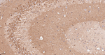 Dynamin 2 Antibody in Immunohistochemistry (Paraffin) (IHC (P))