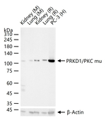 PKC mu Recombinant Rabbit Monoclonal Antibody (8B4)