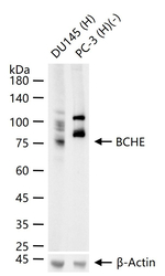 Butyrylcholinesterase Recombinant Rabbit Monoclonal Antibody (4B3)