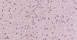 HP1 gamma Antibody in Immunohistochemistry (Paraffin) (IHC (P))