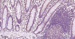HP1 gamma Antibody in Immunohistochemistry (Paraffin) (IHC (P))