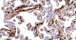 Factor XIII A Antibody in Immunohistochemistry (Paraffin) (IHC (P))