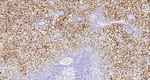 Factor XIII A Antibody in Immunohistochemistry (Paraffin) (IHC (P))