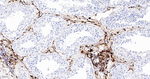 Factor XIII A Antibody in Immunohistochemistry (Paraffin) (IHC (P))
