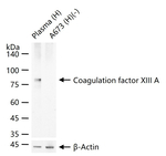 Factor XIII A Antibody in Western Blot (WB)
