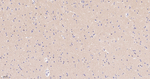 EDG2 Antibody in Immunohistochemistry (Paraffin) (IHC (P))