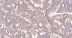 EDG2 Antibody in Immunohistochemistry (Paraffin) (IHC (P))