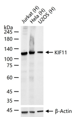 KIF11 Recombinant Rabbit Monoclonal Antibody (11C8)
