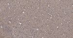 SLIT2 Antibody in Immunohistochemistry (Paraffin) (IHC (P))