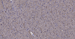 SLIT2 Antibody in Immunohistochemistry (Paraffin) (IHC (P))