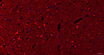 SLIT2 Recombinant Rabbit Monoclonal Antibody (6A9)