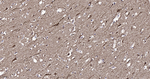SLIT2 Antibody in Immunohistochemistry (Paraffin) (IHC (P))