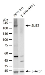 SLIT2 Antibody in Western Blot (WB)
