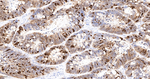 Galectin 4 Antibody in Immunohistochemistry (Paraffin) (IHC (P))
