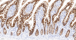 Galectin 4 Recombinant Rabbit Monoclonal Antibody (8A4)
