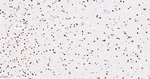 NR2F1 Antibody in Immunohistochemistry (Paraffin) (IHC (P))