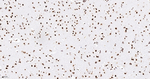 NR2F1 Antibody in Immunohistochemistry (Paraffin) (IHC (P))