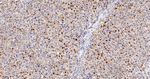 NR2F1 Antibody in Immunohistochemistry (Paraffin) (IHC (P))