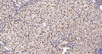 NR2F1 Antibody in Immunohistochemistry (Paraffin) (IHC (P))