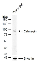 CLGN Antibody in Western Blot (WB)