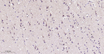 ATG4A Antibody in Immunohistochemistry (Paraffin) (IHC (P))