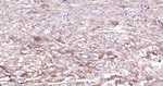 ATG4A Antibody in Immunohistochemistry (Paraffin) (IHC (P))