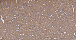 Dynamin 1 Recombinant Rabbit Monoclonal Antibody (2E9)