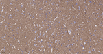 Dynamin 1 Antibody in Immunohistochemistry (Paraffin) (IHC (P))