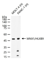 HB9 Antibody in Western Blot (WB)