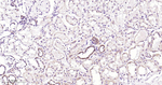 NDUFS3 Antibody in Immunohistochemistry (Paraffin) (IHC (P))