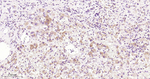 NDUFS3 Antibody in Immunohistochemistry (Paraffin) (IHC (P))