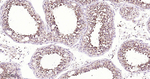 NDUFS3 Antibody in Immunohistochemistry (Paraffin) (IHC (P))