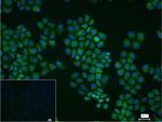 Fascin Recombinant Rabbit Monoclonal Antibody (4F8)
