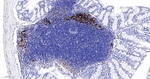 Fascin Antibody in Immunohistochemistry (Paraffin) (IHC (P))