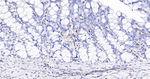 Fascin Antibody in Immunohistochemistry (Paraffin) (IHC (P))