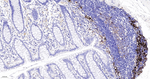 Fascin Antibody in Immunohistochemistry (Paraffin) (IHC (P))