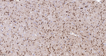 Fascin Antibody in Immunohistochemistry (Paraffin) (IHC (P))