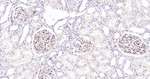 Fascin Antibody in Immunohistochemistry (Paraffin) (IHC (P))