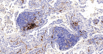 Fascin Antibody in Immunohistochemistry (Paraffin) (IHC (P))