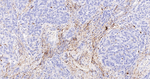 Fascin Antibody in Immunohistochemistry (Paraffin) (IHC (P))