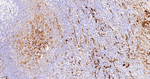 Fascin Antibody in Immunohistochemistry (Paraffin) (IHC (P))